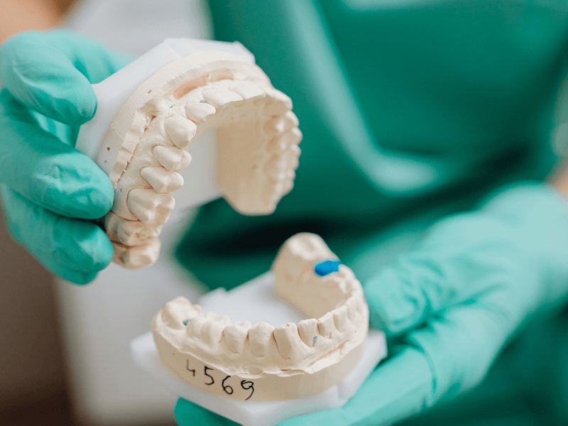 &iquest;Cu&aacute;nto cobra un prot&eacute;sico dental? Sal de dudas ahora