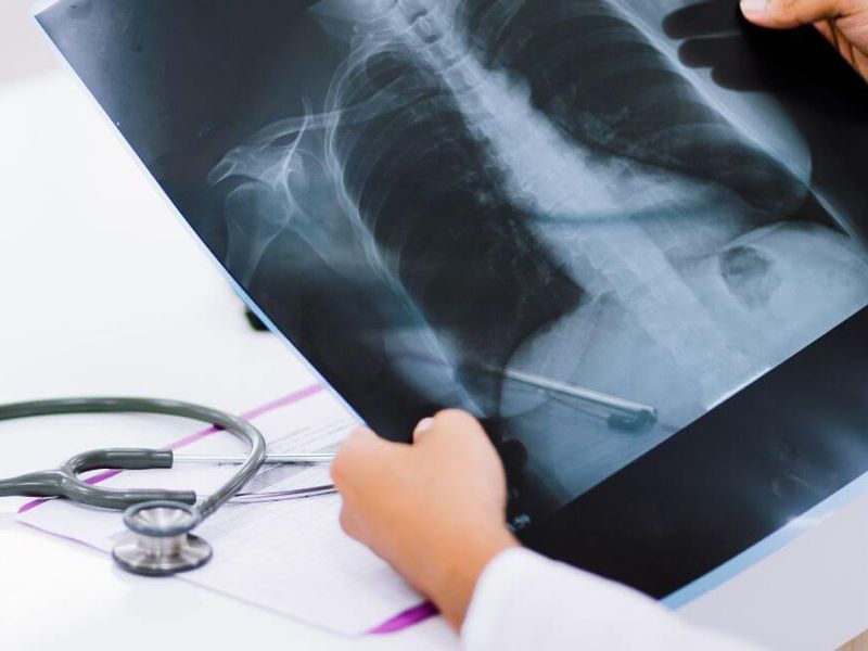 Densidades radiol&oacute;gicas, &iquest;por qu&eacute; su importancia es clave para estos estudiantes?