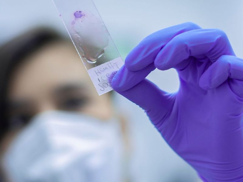 T&eacute;cnico superior en laboratorio cl&iacute;nico y biom&eacute;dico sueldo