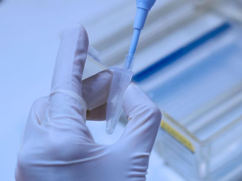 Tipos de electrof&oacute;resis, &iquest;cuales existen?