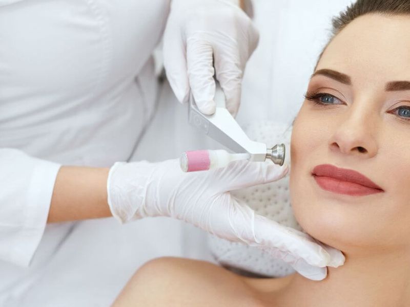 Crioterapia est&eacute;tica, &iquest;para qu&eacute; sirve?